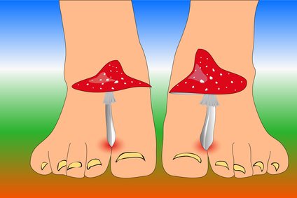 Fussexperten Pa Twitter Fusspilz Nagelpilz Da Musst Du Etwas Tun T Co V6tevluwzf Fusspilz Sportlerfuss Fusspflege Nagelpilz