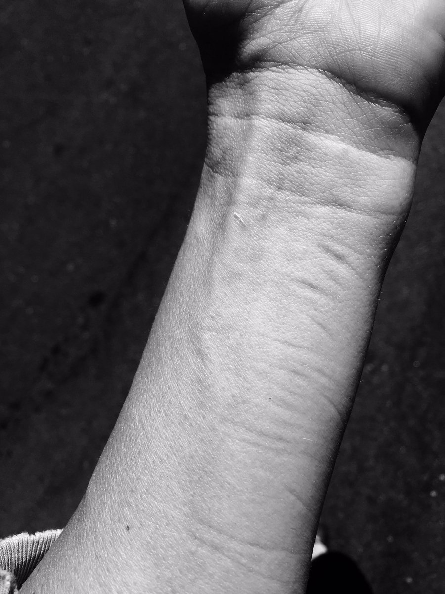 The shit you do to yourself while rehearsing intense stuff without realizing you are really doing  @urbandeath_zju @zombiejoes #horror