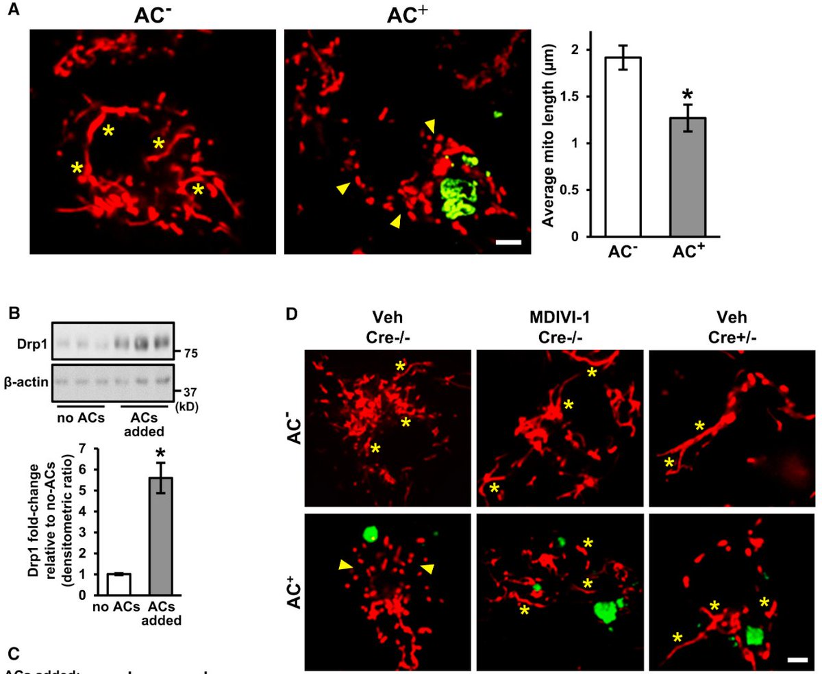 mmw_lmw's tweet photo. #MacroPhage clearance of #ApoptoticCells involves #MitoChondrial Fission | IraTabas @Columbia @CellCellPress https://t.co/q1jArJufUj https://t.co/CmXI7mpicS