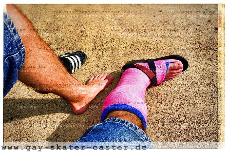 GaySkaterCaster's tweet photo. 2016-06 slwc
#slwc #castshoe #toeplate #gay #castfetish #brokenleg #legcast
24 Sep 2017: pix added

https://t.co/cK54n9V3xY https://t.co/bNYboqrgXA