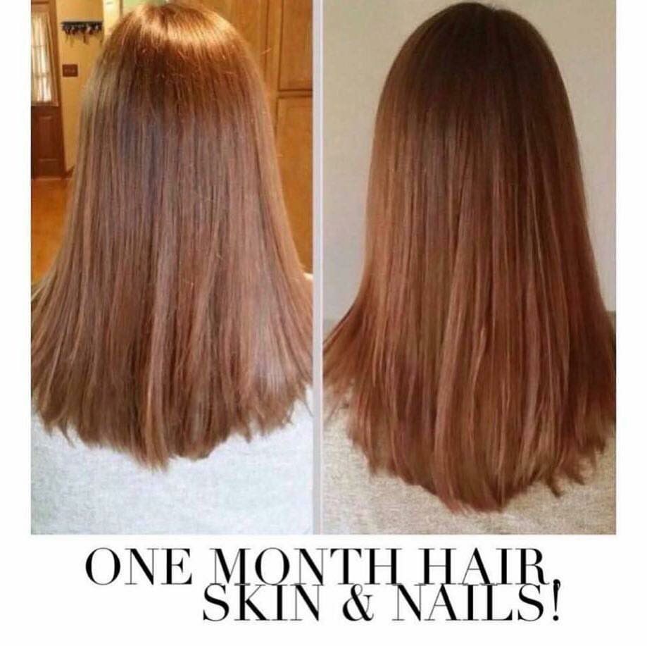 Ashleys_ItWorks's tweet photo. One ☝🏼 month of HairSkinNails 💇🏻💁🏻💅🏼 https://t.co/f0CRN0BVxr