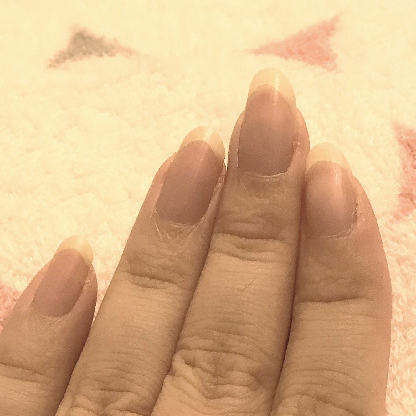 せれりぃ No Twitter ギター1ヶ月いじってないから 左手の爪がめちゃくちゃキレーに伸びている それにしても 昔から人差し指が曲がっている 指を伸ばすと 人差し指と中指の間に隙間が開くほど曲がっている ちなみに右も同じ 右は人差し指と中指どっちも曲がって せれりぃ No Twitter ギター1ヶ月いじってないから 左手の爪がめちゃくちゃキレーに伸びている それにしても 昔から人差し指が曲がっている 指を伸ばすと 人差し指と中指の間に隙間が開くほど曲がっている ちなみに右も同じ 右は人差し指と中指どっちも曲がって