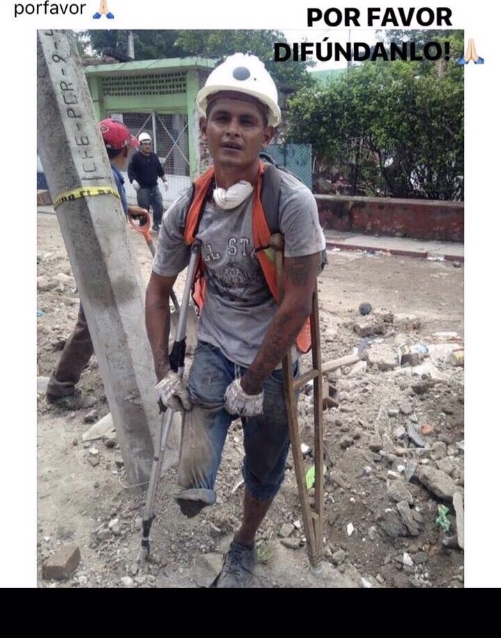 Ayuda para contactarlo. Hector de Jojutla ! Yo le pago de corazón la prótesis !!!!