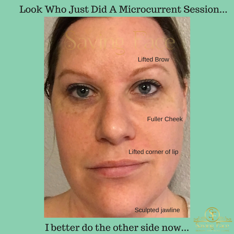 SavingFaceSpa's tweet photo. Talk about a Quick Facelift. I just love Microcurrent.
Look great for a big event, series for a long lasting effect.
#MicrocurrentFaceLift https://t.co/4uTJk4WLXJ