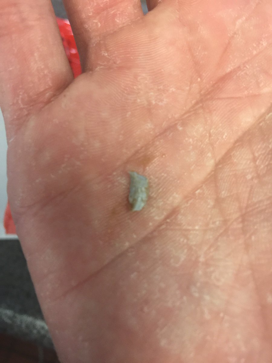 ReignDropZ tweet media