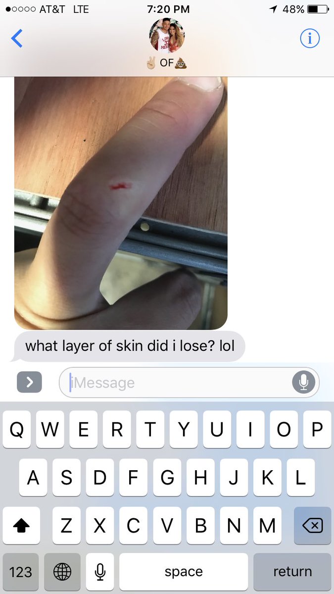 _dorrrii's tweet image. Bc he knows I'm learning about layers of the skin in school😂😂❤️ #TSII