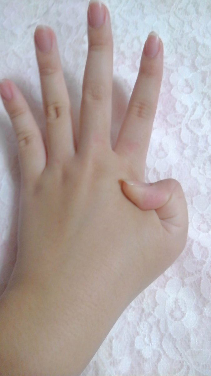みゆ みなさんこんな感じに指が動きますか 私は二重関節って言うやつらしいです 前後左右に指が動きます 関節が特殊だとか 出来る方いますか 挑戦してみてください 二重関節 拡散希望 特殊 関節ぐにゃぐにゃ 90度に反らせることも可能です みゆ みなさんこんな感じに指が動きますか 私は二重関節って言うやつらしいです 前後左右に指が動きます 関節が特殊だとか 出来る方いますか 挑戦してみてください 二重関節 拡散希望 特殊 関節ぐにゃぐにゃ 90度に反らせることも可能です