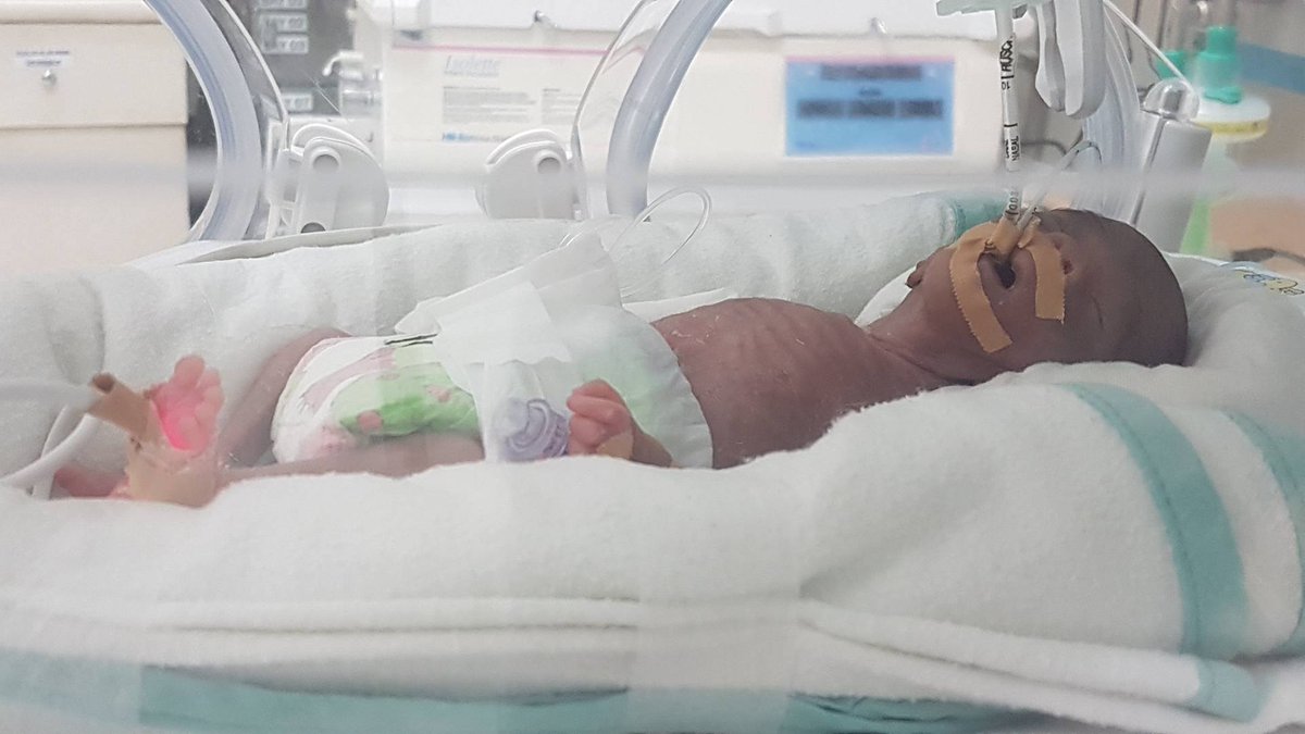 GoGetFunding's tweet image. This family's heartbreaking campaign needs your support. #Twins #Loss #Medical #BabyMatthew gogetfunding.com/baby-matthew-p…