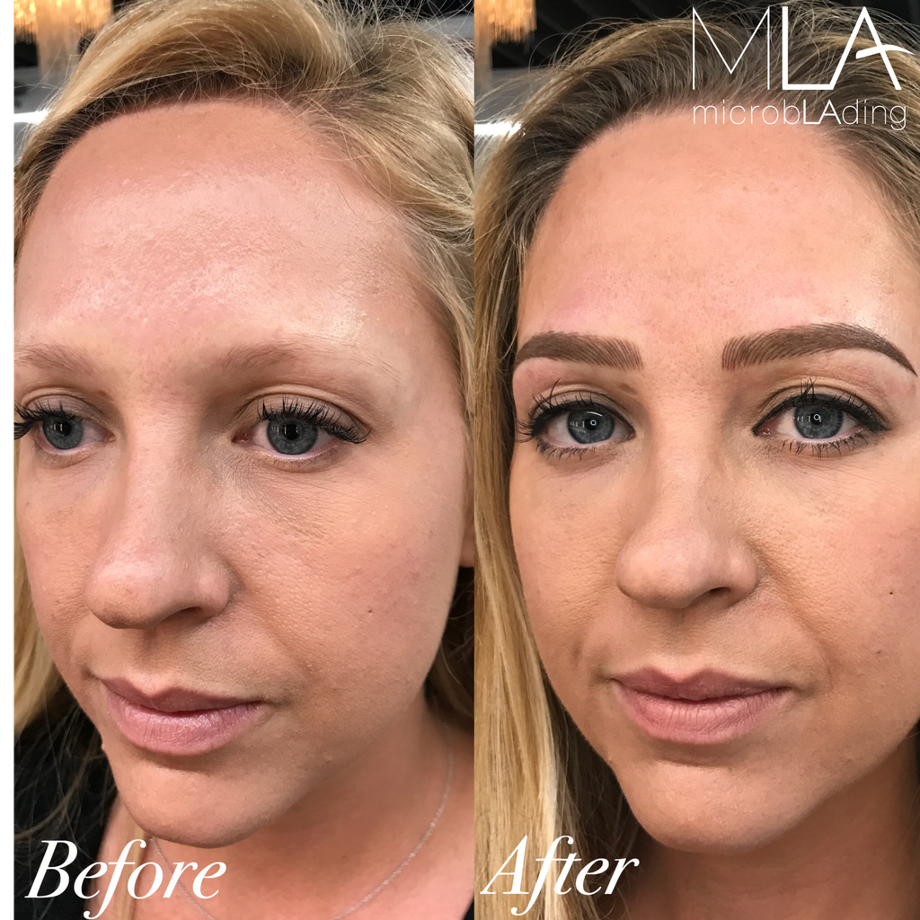 microbladingla's tweet photo. COMBO brows🔥This technique creates a stunning, bold brow using a combination of two techniques-microblading and shading🖋🎀
#microblading #pmu https://t.co/P0Q8vJAeLt