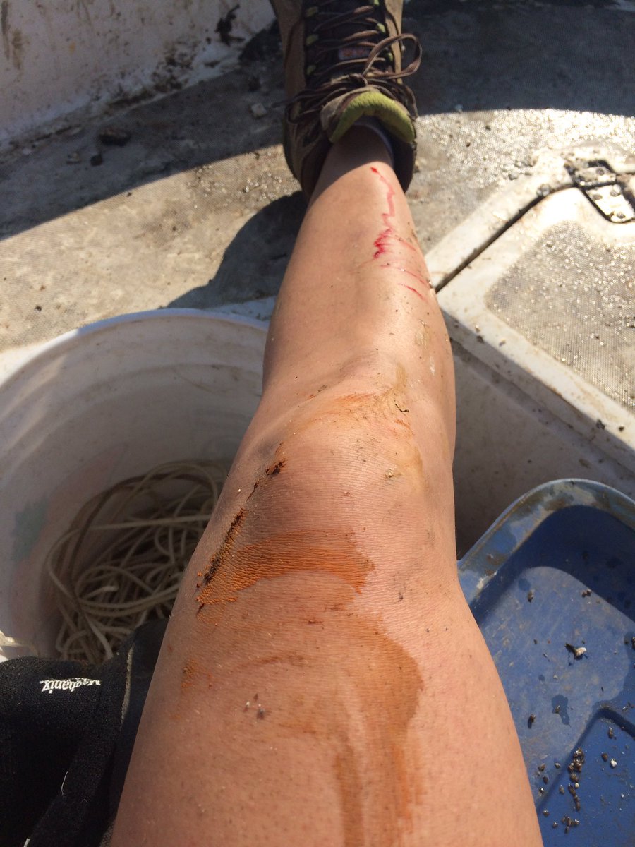 Ladyfishbio's tweet photo. A hard but successful day pulling up receivers from the bottom of Lake O. Can't wait to find out what fish were detected! #DFO_science https://t.co/xQxS34zYT5