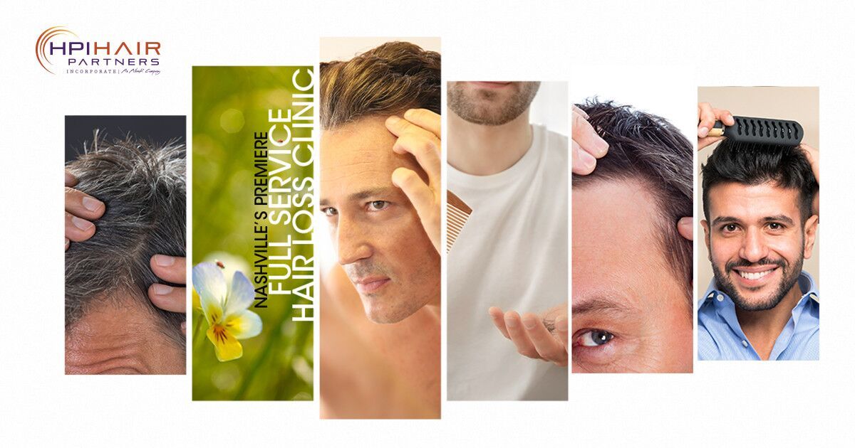 Hpihairpartners On Twitter Thinning Hairloss Men Genetic