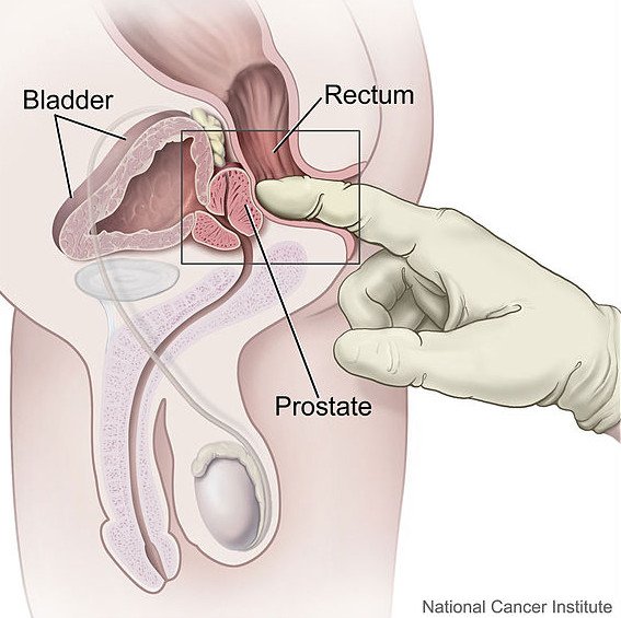 CrazyZoe_'s tweet photo. Comment pratiquer le massage de la prostate https://t.co/qEcopGCaq3 https://t.co/540768ixsu