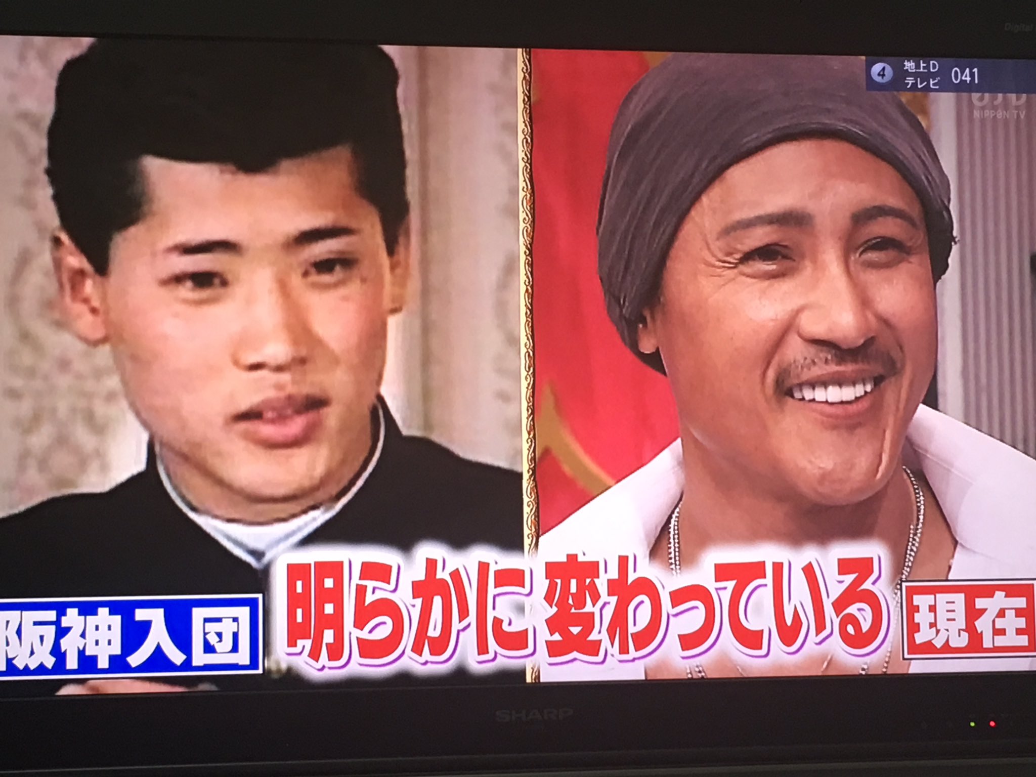 新庄 剛志 整形 前
