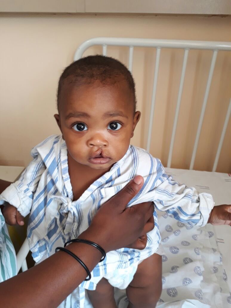 SmileFundSA's tweet photo. We are beyond happy that 5 month old  Mushi's life is about to change forever at DGMAH, supported by the ICC Buying Group. https://t.co/CWxSsxZ0zp