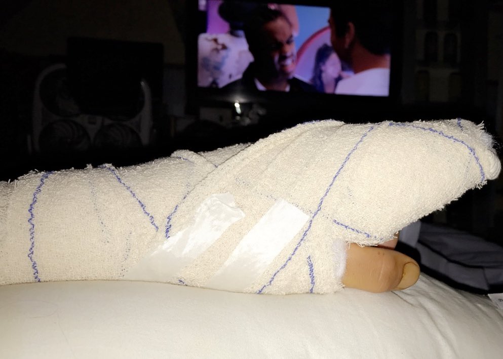 Dès que je peux reconduire je vous présente ma nouvelle moto ✌🏻✌🏻#tendonsectionné