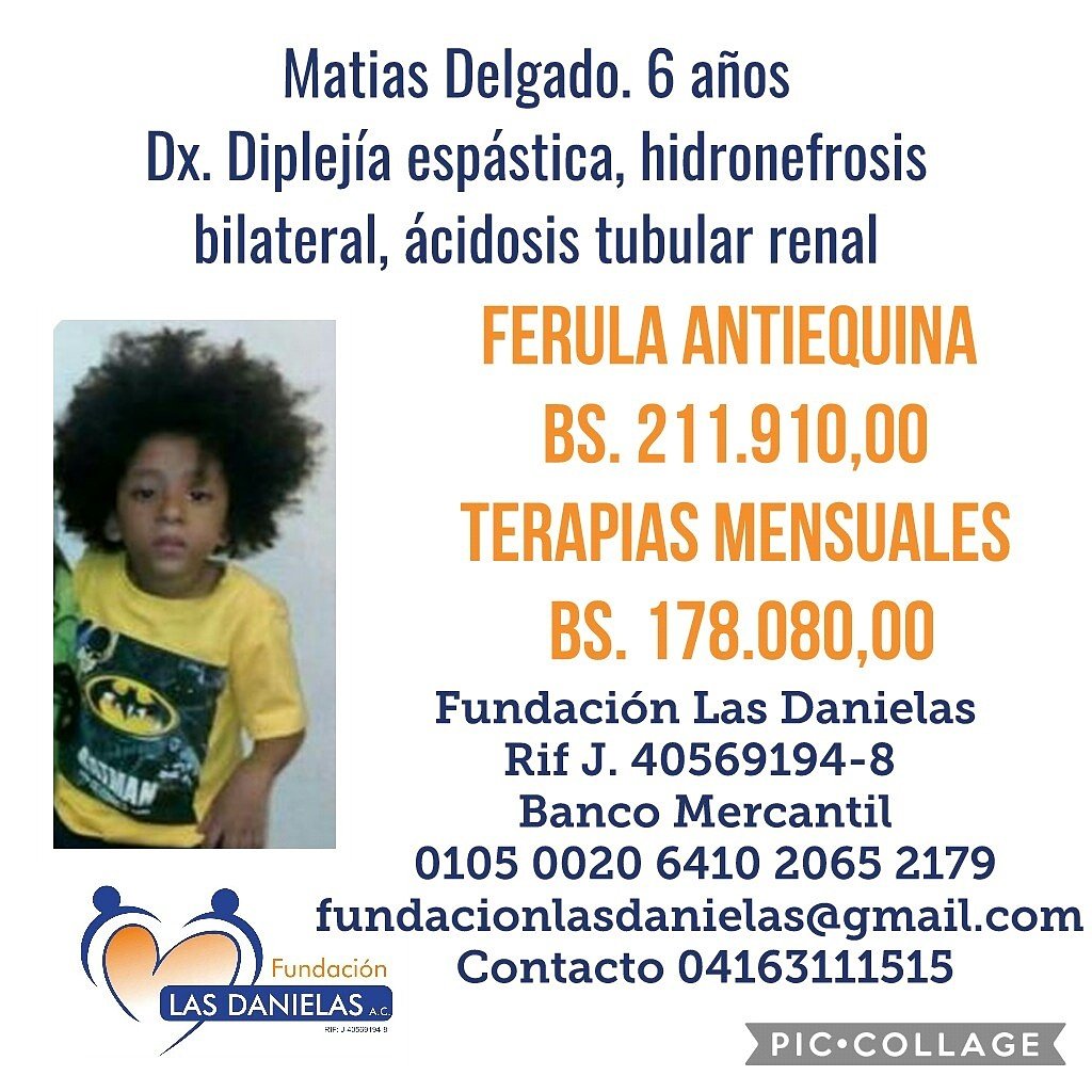 FundLasDanielas's tweet photo. Con tu aporte podemos ayudar a Matias para que tenga sus ferulas antiequinas y asista a sus terapias semanales #FunDani @uncafeconshia https://t.co/aXVpJW4jxS