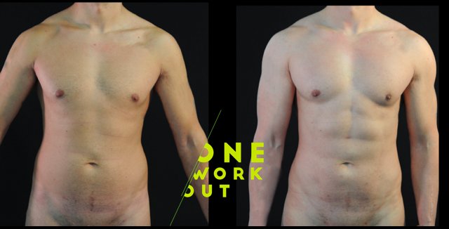 AlfredoHoyosMD's tweet photo. Let's face it, fellas: We all want our abs to look like Zac Efron's in Neighbors? #liposculpture #vaserhidef #plasticsurgery https://t.co/u5JBRT9Ywz