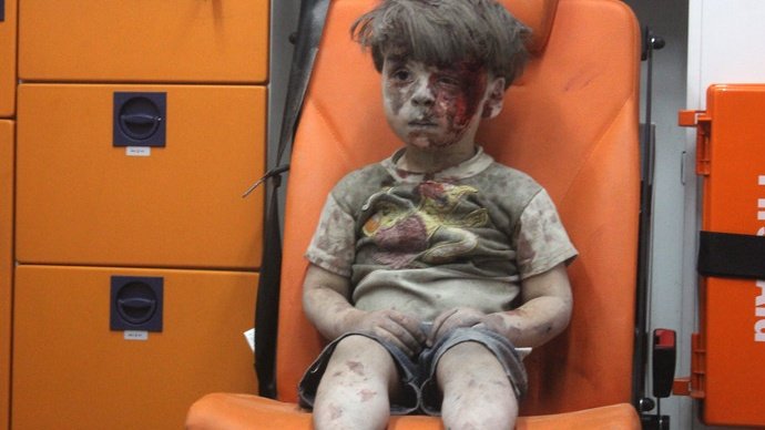 theskindoctor13's tweet photo. Agenda driven photo- journalists all over the world are manipulating victims to get that perfect shot. Don't fall for manufactured emotions. https://t.co/b3IXiotrH0