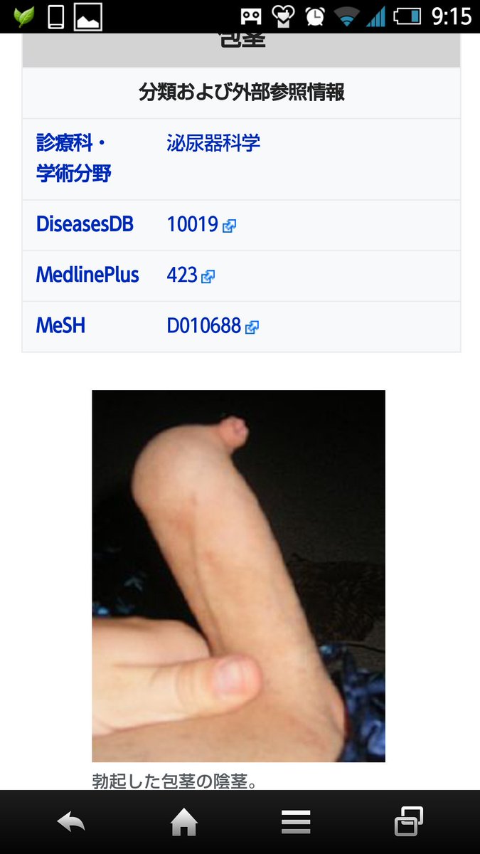 いーちゃむ 鉄拳 そんなことより 包茎のwikipediaの画像で笑わない奴おる 水風船かな いーちゃむ 鉄拳 そんなことより 包茎のwikipediaの画像で笑わない奴おる 水風船かな