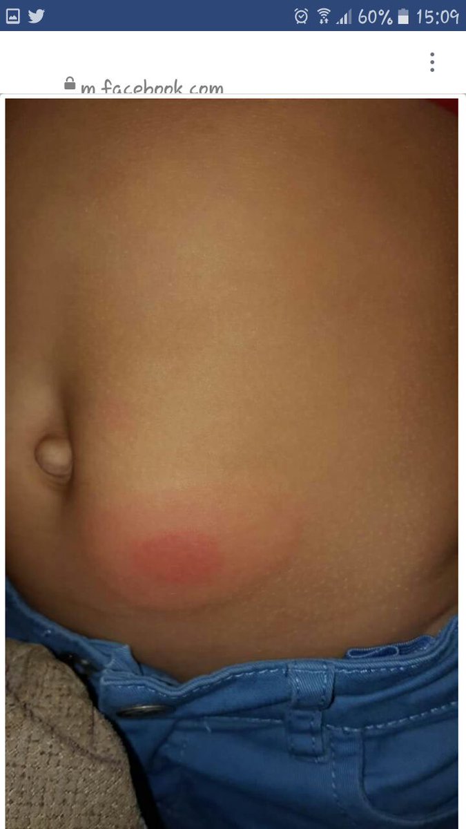 Stop_Mosquitos's tweet photo. San Julián, en esta zona aumenta el número de mosquitos. @lmedina63 @RaulJimenezJ  @malaga @Noemmoncayo @rampyta @BarriosMalaga https://t.co/ErELXqFSAB