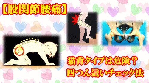 股関節腰痛
