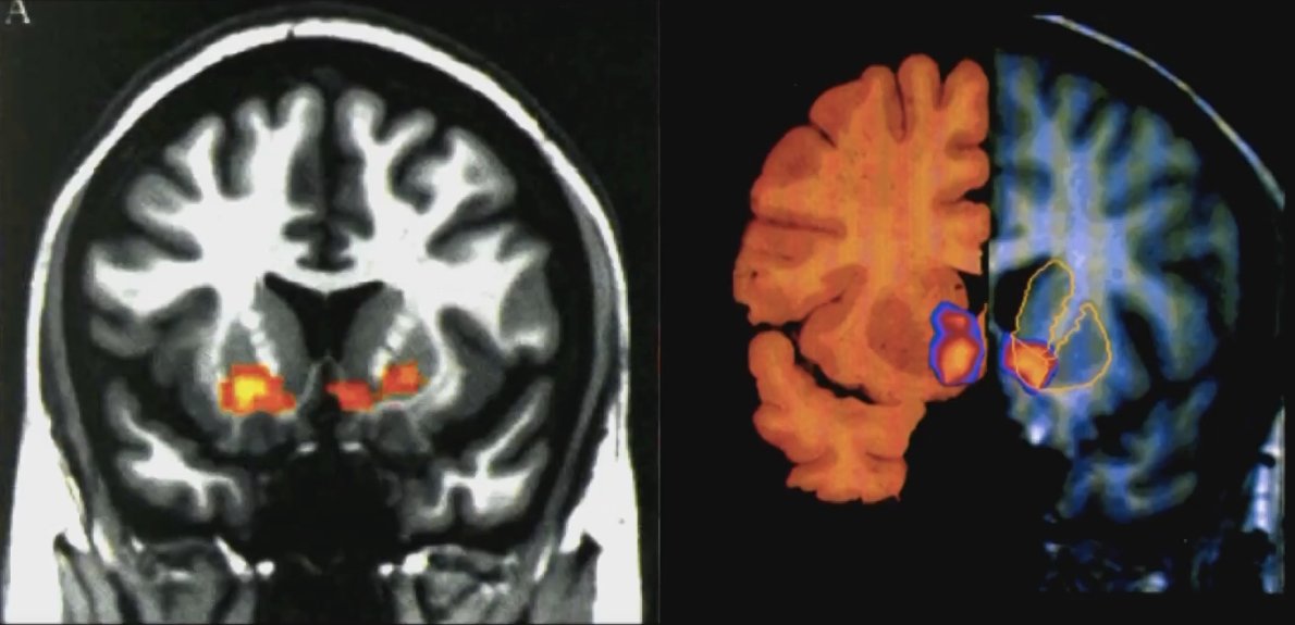 See the @tpcag Future Day presentation on the effects of Media Consumption on our brains. Facebook vs. Cocaine... bit.ly/2wWB85D