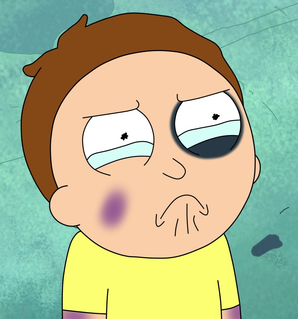 DramaticSlick_'s tweet image. Thanks @ImpvlsiveWander