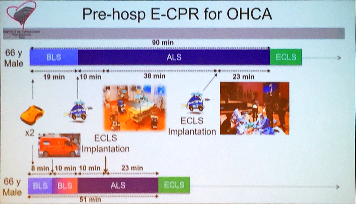 David Gattas (@dgattas) on Twitter photo Nicolas Bréchot discusses the big issue in pre-hospital ECPR: scoop-and-run vs stay-and-play <a href="/APELSO_2017/">APELSO 2017</a> #ecpr #APELSO2017 Nicolas Bréchot discusses the big issue in pre-hospital ECPR: scoop-and-run vs stay-and-play <a href="/APELSO_2017/">APELSO 2017</a> #ecpr #APELSO2017