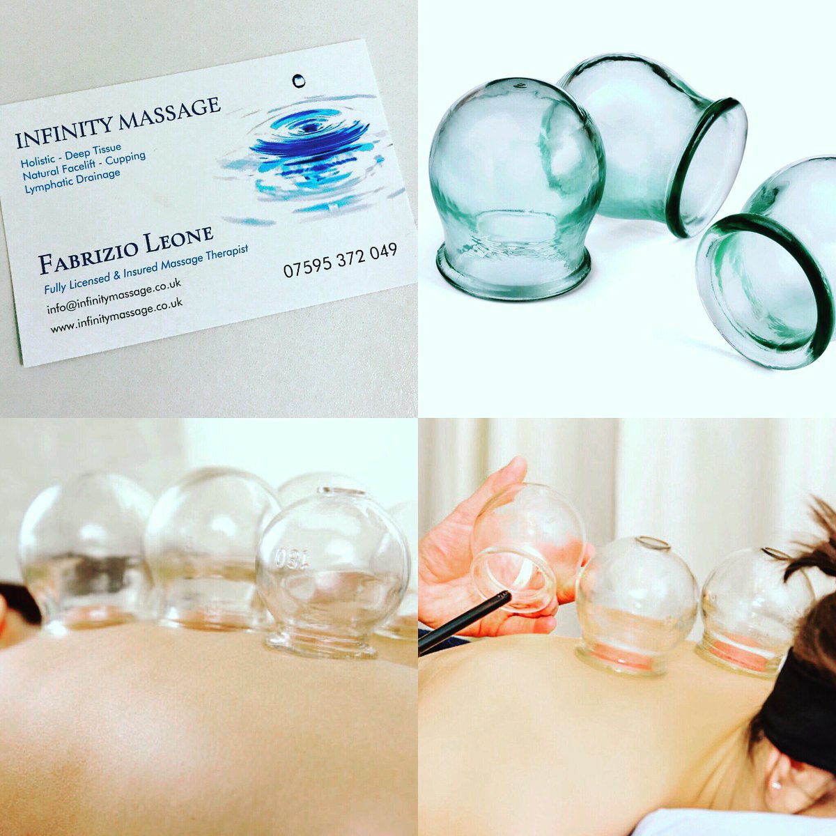 leonefabrizio's tweet photo. Effective Therapeutic Massage today! Old st Islington Hackney #mld #deep_tissue #cupping #sports_therapy #lymphatic https://t.co/UGhckZg5qa https://t.co/M8vk3lMLFS