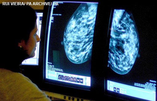 bmj_latest's tweet photo. UK doesn't have enough radiologists to meet demand in the #NHS, @RCRadiologists warns. @Abi_Rimmer reports https://t.co/9FSi94Sqeh https://t.co/CwQygFo4z9