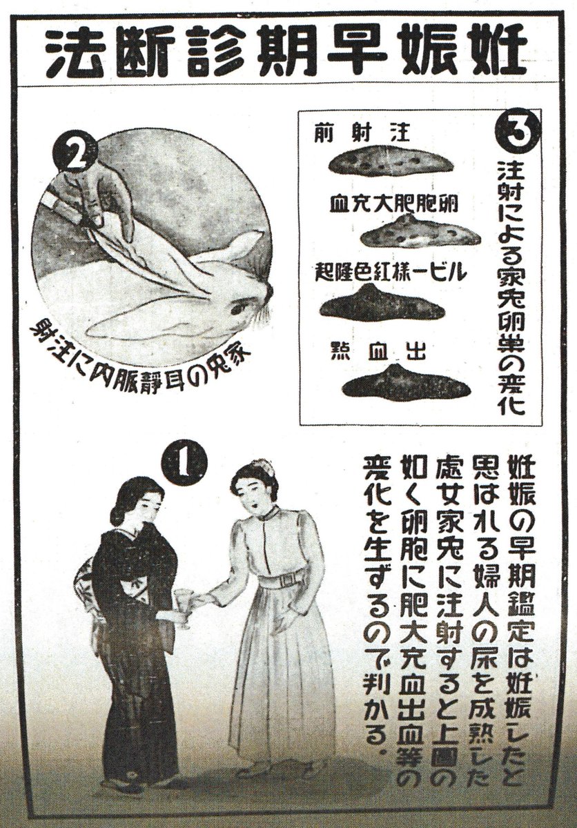 【動物を用いた妊娠検査】
1929年に発見され60年代頃まで使われた妊娠早期診断法
・処女のウサギ(ネズミやカエル)の耳の静脈に尿を注射して24時間後に解剖し卵巣を検査する 排卵が起こっていれば陽性
・ウサギの眼球に卵巣を移植し尿を注射する 陽性だと眼球が肥大充血する
#衛生展 
