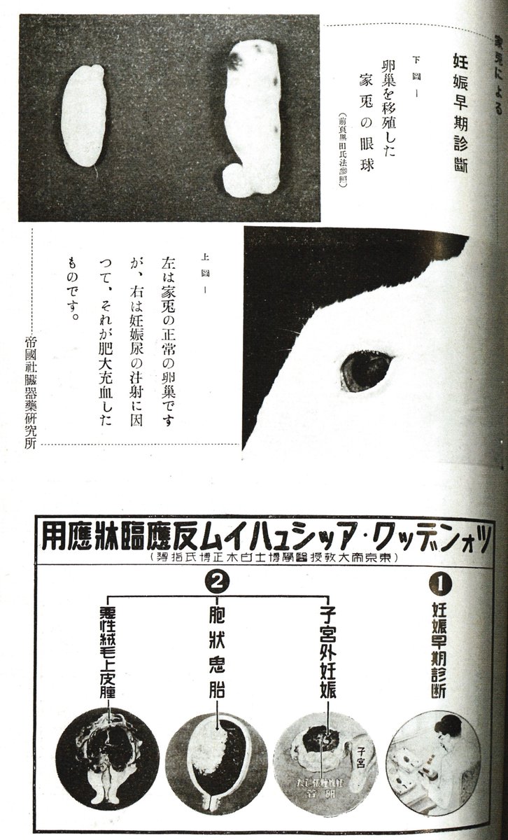 【動物を用いた妊娠検査】
1929年に発見され60年代頃まで使われた妊娠早期診断法
・処女のウサギ(ネズミやカエル)の耳の静脈に尿を注射して24時間後に解剖し卵巣を検査する 排卵が起こっていれば陽性
・ウサギの眼球に卵巣を移植し尿を注射する 陽性だと眼球が肥大充血する
#衛生展 