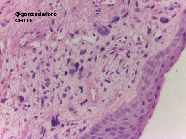 Gonzalo De Toro tweet media