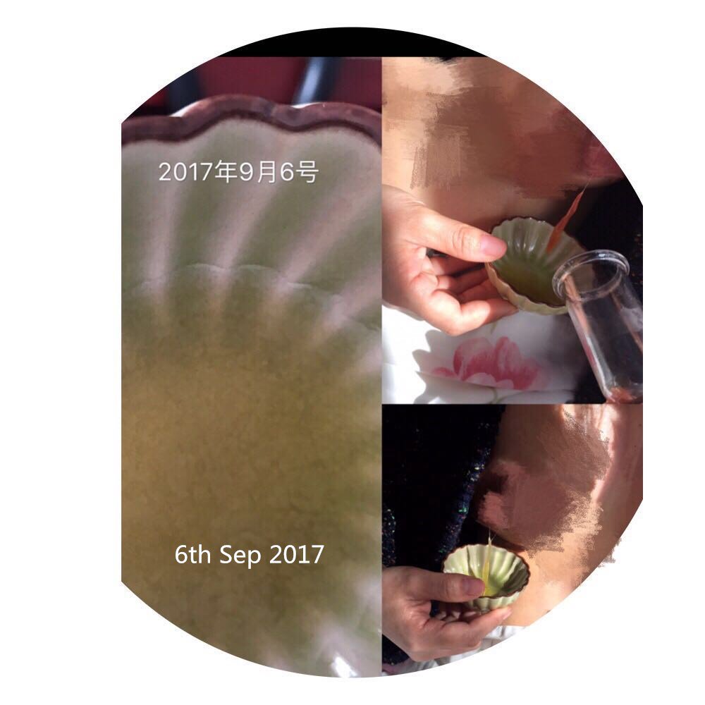 AfricanBiboting's tweet photo. How we saves one woman , and preventing her getting breast cancer. Attached photo shows the whole process , help her pull lump out of breast.
1.in early sep, it is yellow liquid , come out2.in later stage, it it red color;3.the blood liquid soon become LUMP again when cold out https://t.co/q076E21DiM
