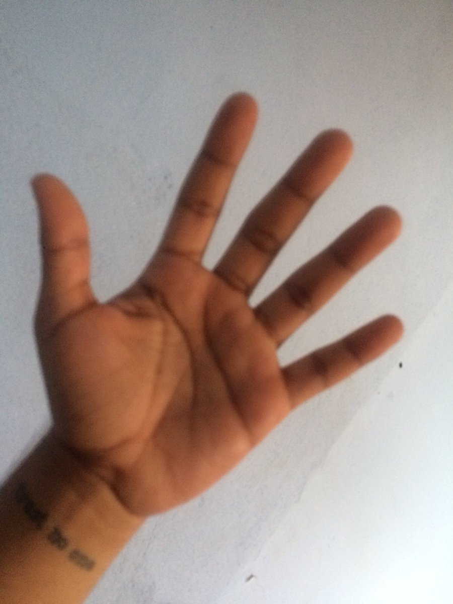 tracajadojapiim's tweet photo. What can I do about camera focus? @Apple @AppleSupport #ios11 #ios1102 https://t.co/ZabM1RlDCv