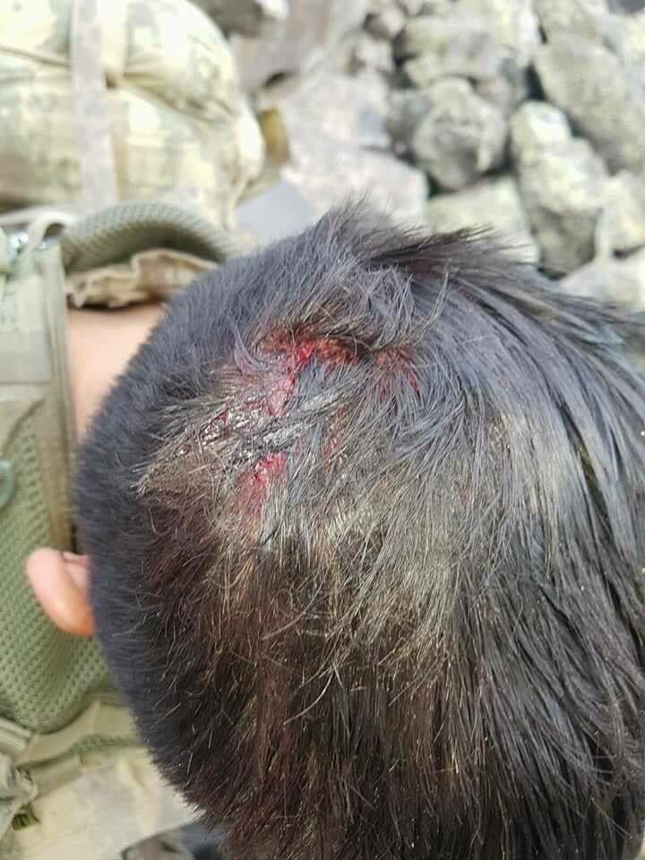 Bu çocukların hakkını asla ödeyemeyiz...