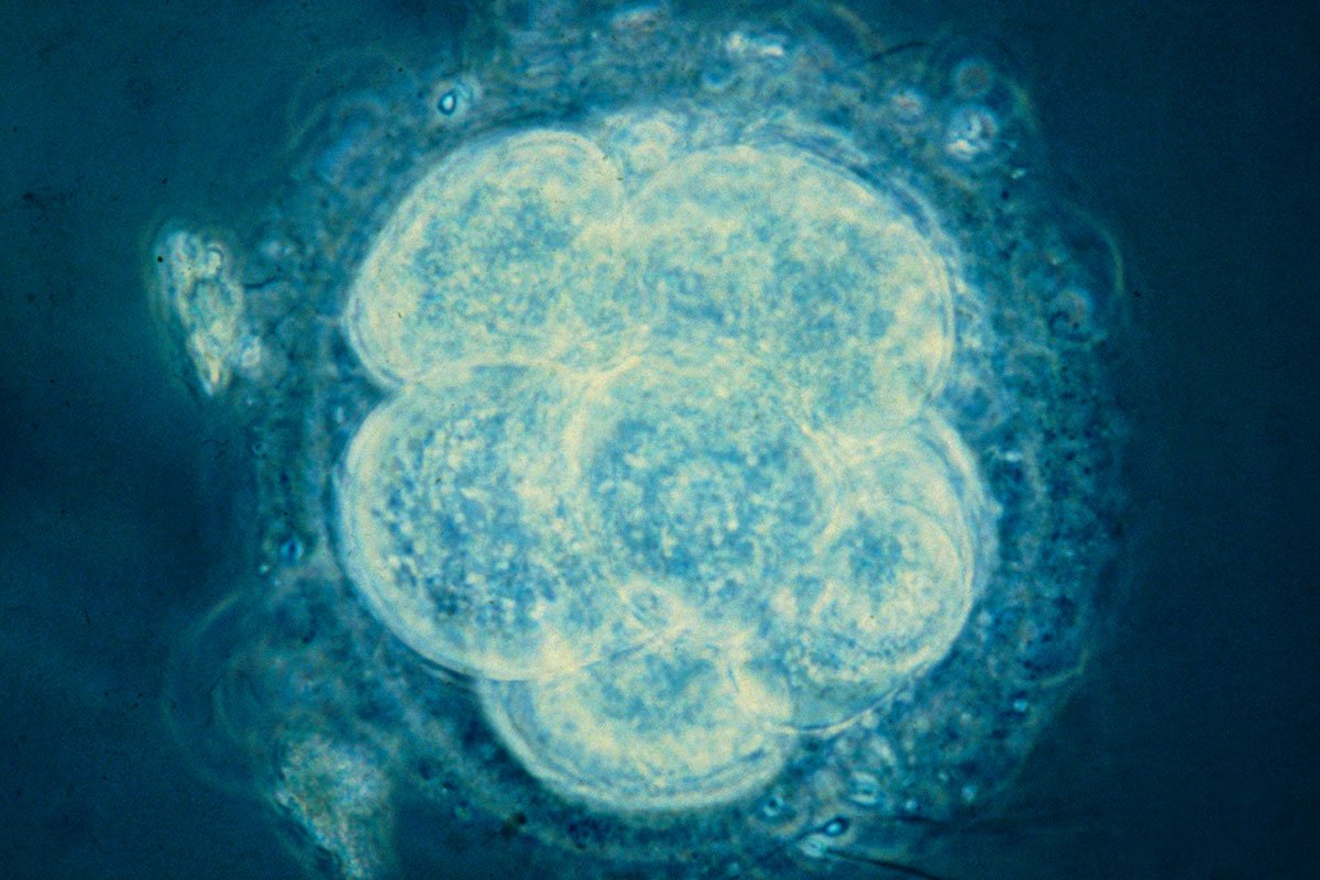 scienceXenia's tweet photo. New Scientist: Most versatile stem cell ever may help us understand miscarriage #betterUnderstand https://t.co/lyANp9vGsI https://t.co/njHfZjdDrj