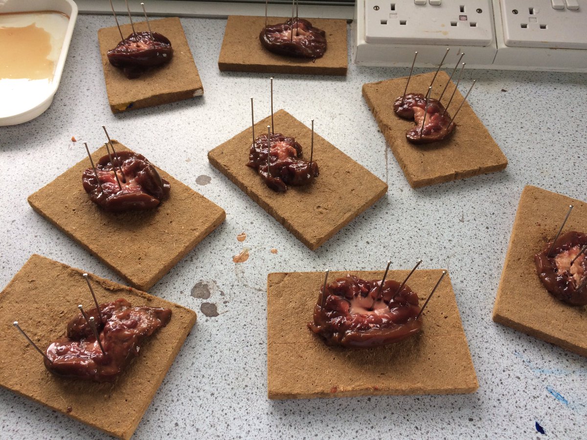 WingfieldSci's tweet photo. Urine for a treat! Well done y11 triple.#kidneydissection https://t.co/Tww6EB08fx