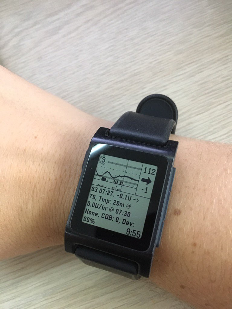 danamlewis's tweet photo. Thanks for having me, @HITSIGVCU #VCUSOM! here's what my #OpenAPS was doing while we were talking: https://t.co/xQZn0ZjIqf
