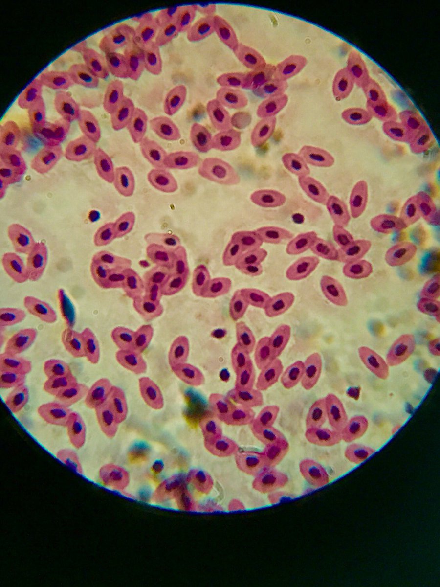 MrCs78Class's tweet photo. Thanks to Emily Legge and her trusty cell phone, we captured some of the microscope cell images that we were studying today! #lancasterdps https://t.co/bNYN88Lovr