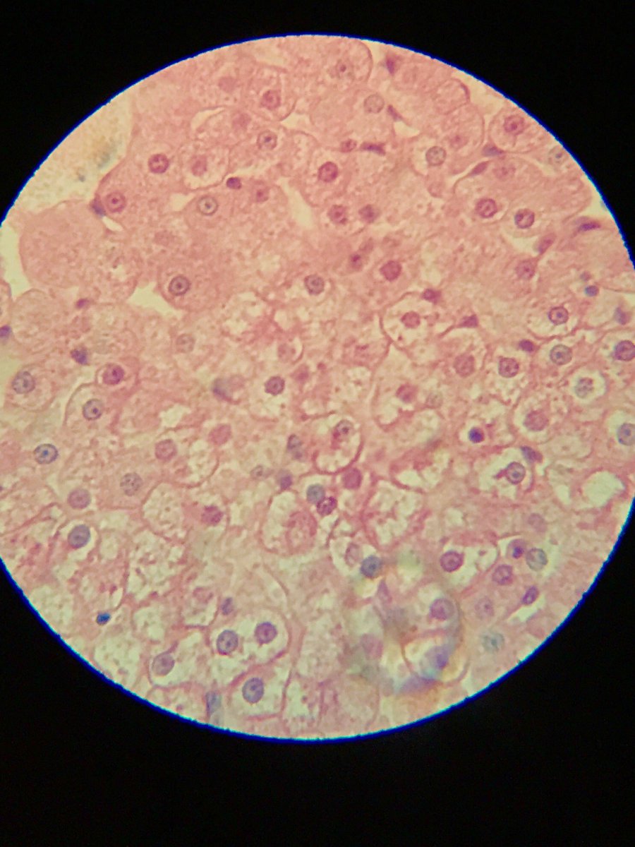 MrCs78Class's tweet photo. Thanks to Emily Legge and her trusty cell phone, we captured some of the microscope cell images that we were studying today! #lancasterdps https://t.co/bNYN88Lovr
