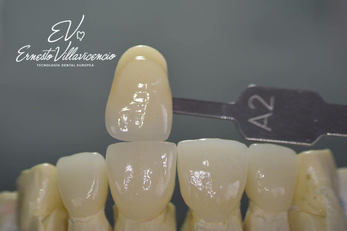 Ernesto_VITA's tweet photo. Perfect Shade VITA Suprinity PC
#vitacadcam #suprinitypc #dentagram #dentalart #dentallab #easyshade #perfectshade #dental #guadalajara https://t.co/VCXjR6HqK6
