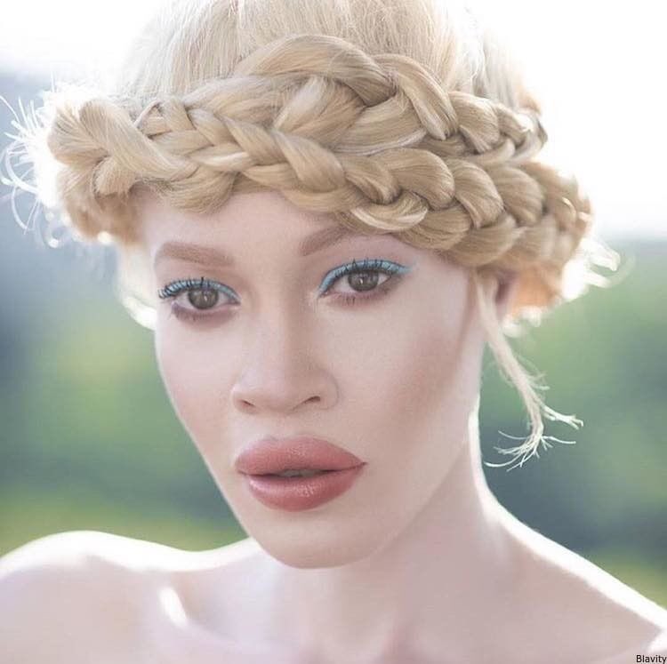 BLACKGIRLSROCK's tweet photo. Diandra Forrest just became the first model with albinism to score a major beauty campaign https://t.co/S8GJzCyXUa https://t.co/9mOjUqWulH