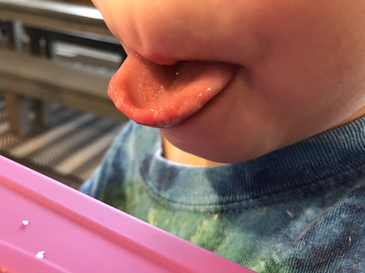 twobigsandtwins's tweet photo. Daycare closes, Lennon gets fever from shots, and now Max has hand foot and mouth all of a sudden? Is this real life? 😩🤦🏽♀️ #callgrandma https://t.co/ew8ZsGi8zK