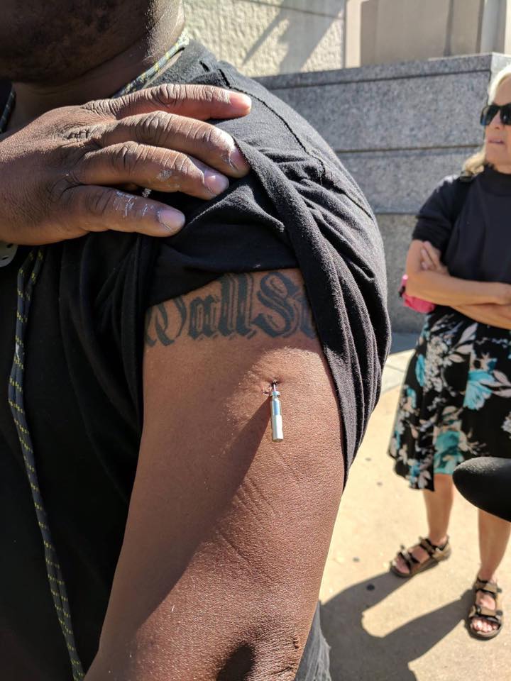 BigJShoota's tweet photo. #StockleyProtest Leader is tased, held in jail, and released w/o medical care. The prong is still in his arm.
https://t.co/jVDMWScRZG