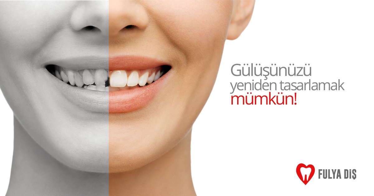 Fulya Diş, diş hekimliğinin tüm alanlarında Tekirdağ’da hizmet vermektedir. Bilgi ve randevu için: fulyadis.com