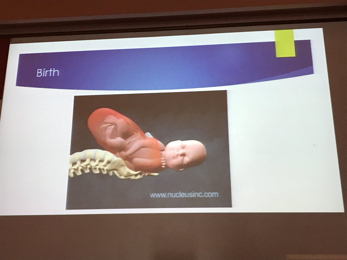 mreyesm's tweet photo. @IrenePedPath talking on #perinatalhypoxia at the #IPPA2017 #IPPA2017 #PediPath course in Venice. https://t.co/1CyrKz3thb