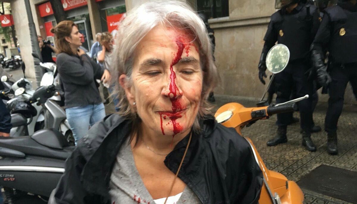 TR'nin teröre karşı sürdürdüğü meşru mücadelesini eleştiren Batı, İspanya'nın #CatalanReferendum müdahalesini görmezden gelecek. Çünkü Batı.