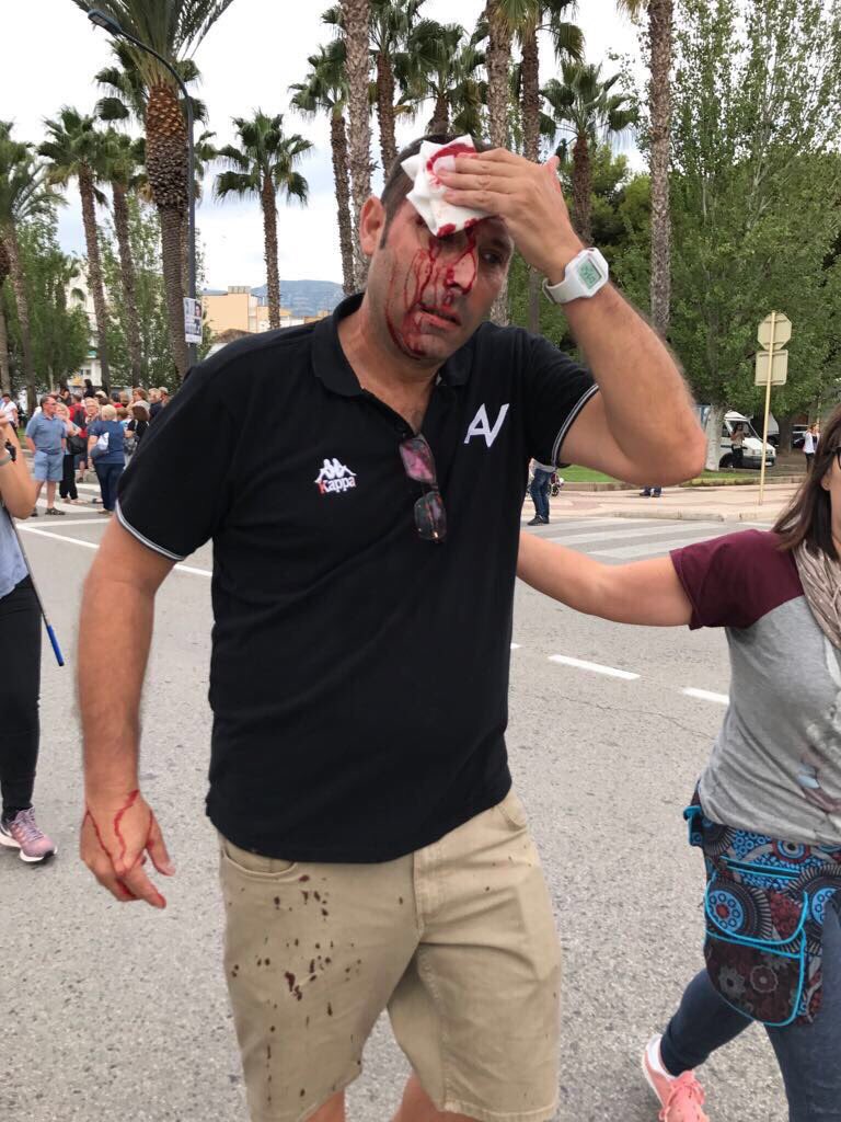 albacorazonegro's tweet photo. Policía llevándose urnas, gente ensangrentada por la violencia policial, la @ONU_es va a hacer algo al respecto? #CatalanReferedendum https://t.co/lDHvRmMECS