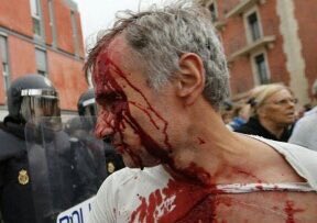 albacorazonegro's tweet photo. Policía llevándose urnas, gente ensangrentada por la violencia policial, la @ONU_es va a hacer algo al respecto? #CatalanReferedendum https://t.co/lDHvRmMECS